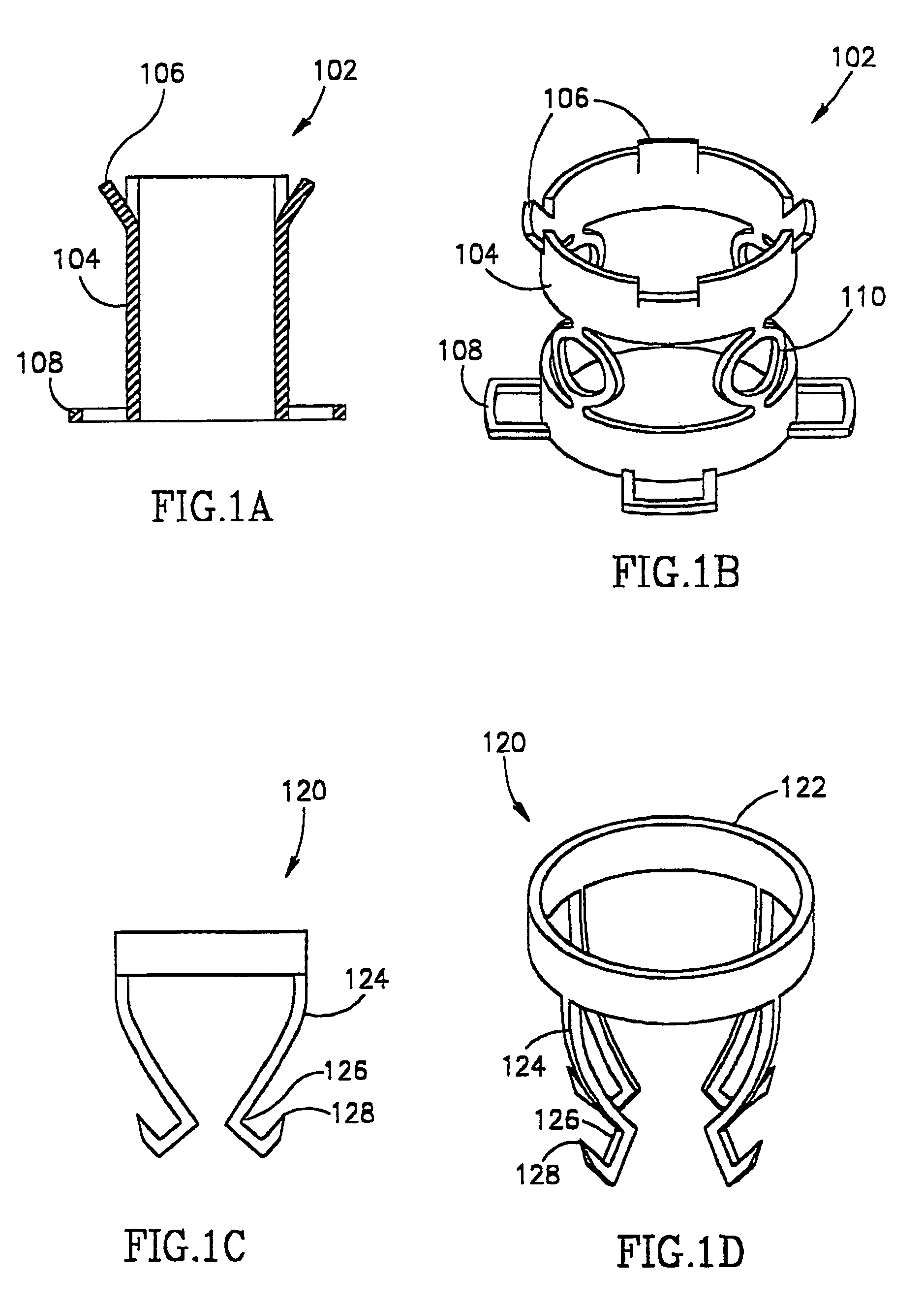 Vascular surgery