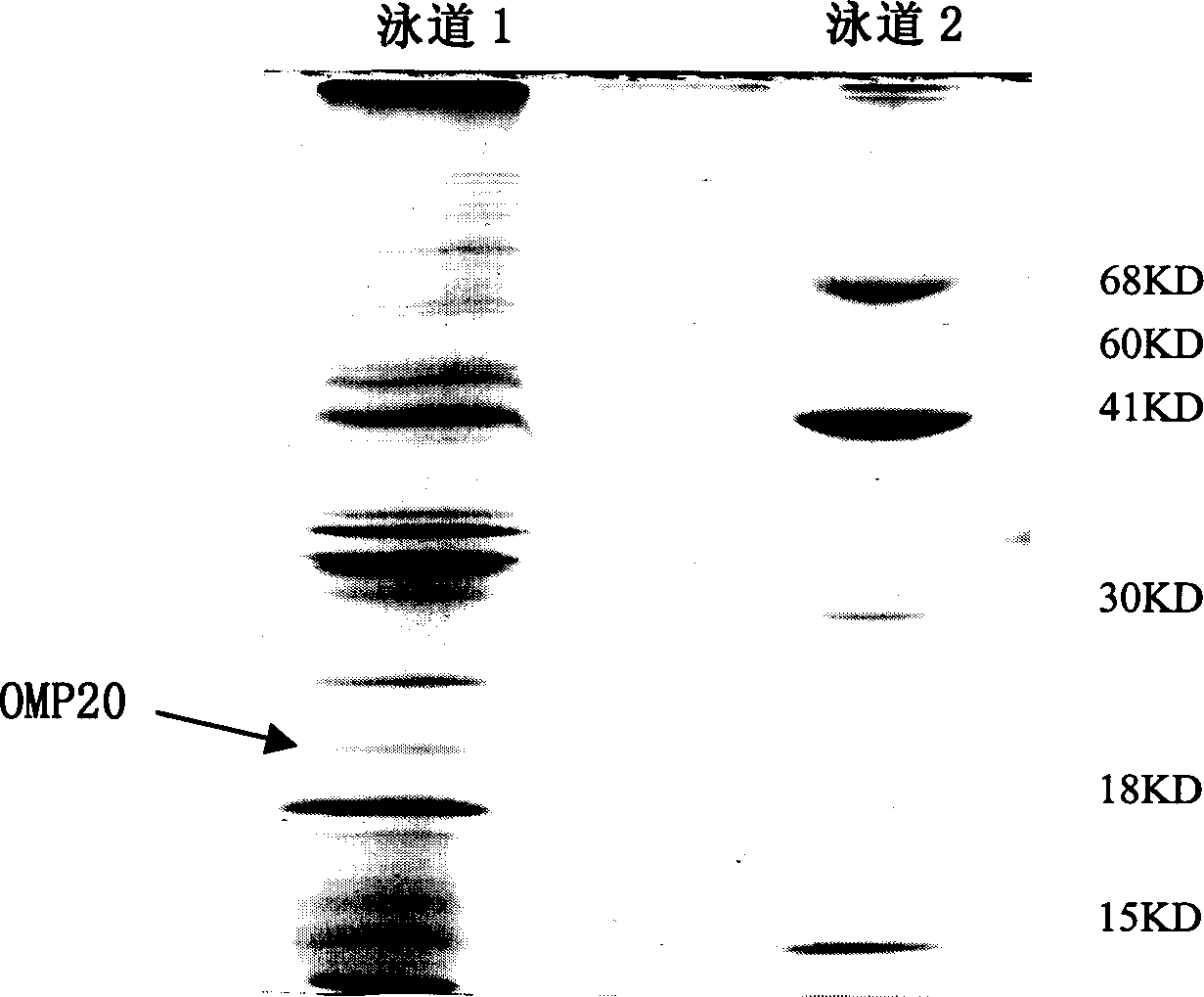 Leptospira adventitial protein, its code sequence and use