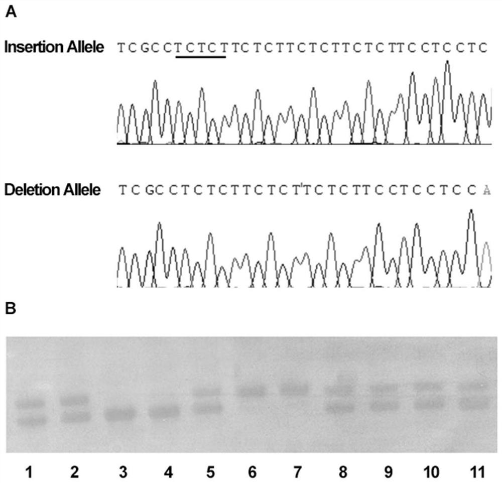 Sudden cardiac death susceptibility detection kit based on STIM1 gene insertion and deletion polymorphic sites