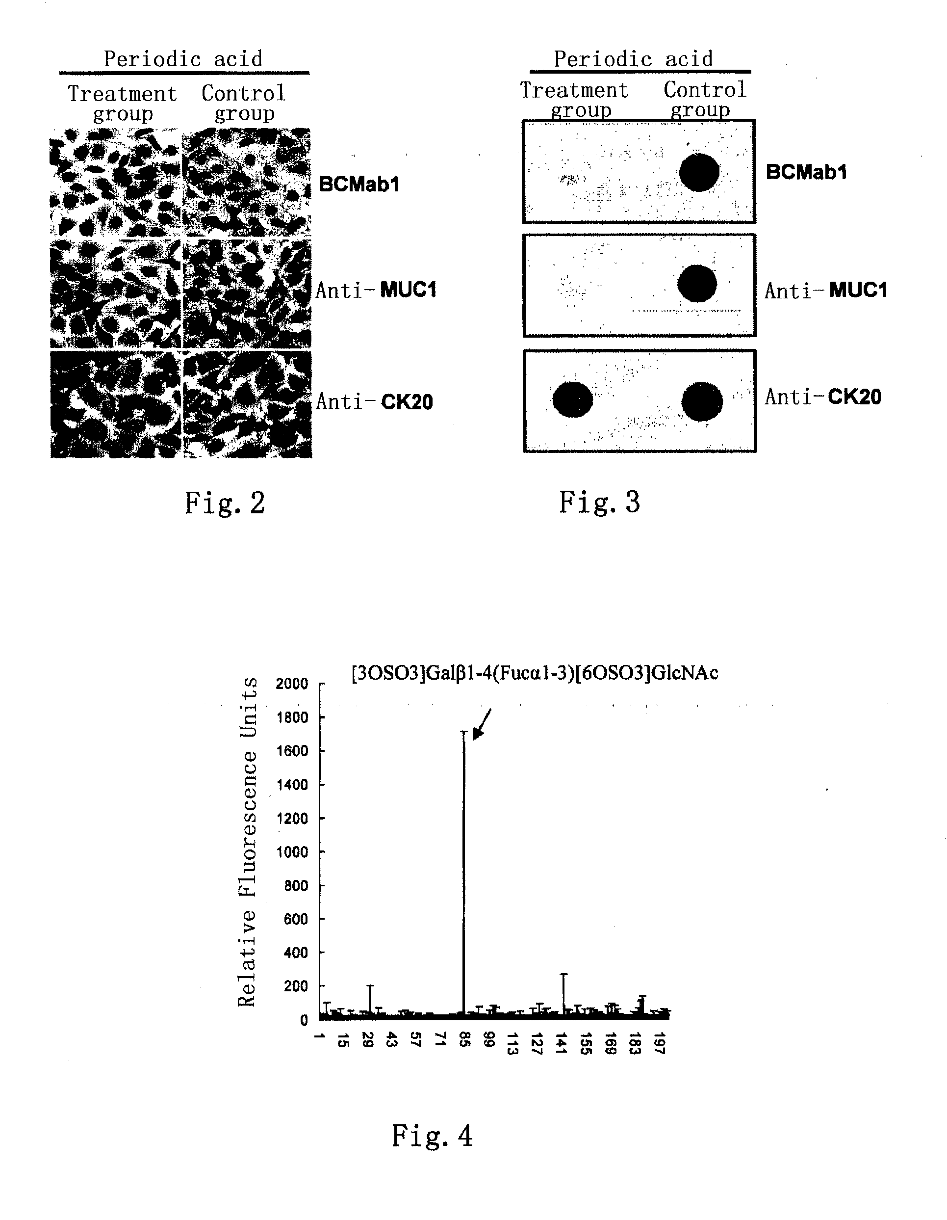 Bladder cancer tumor marker, antibody and use thereof