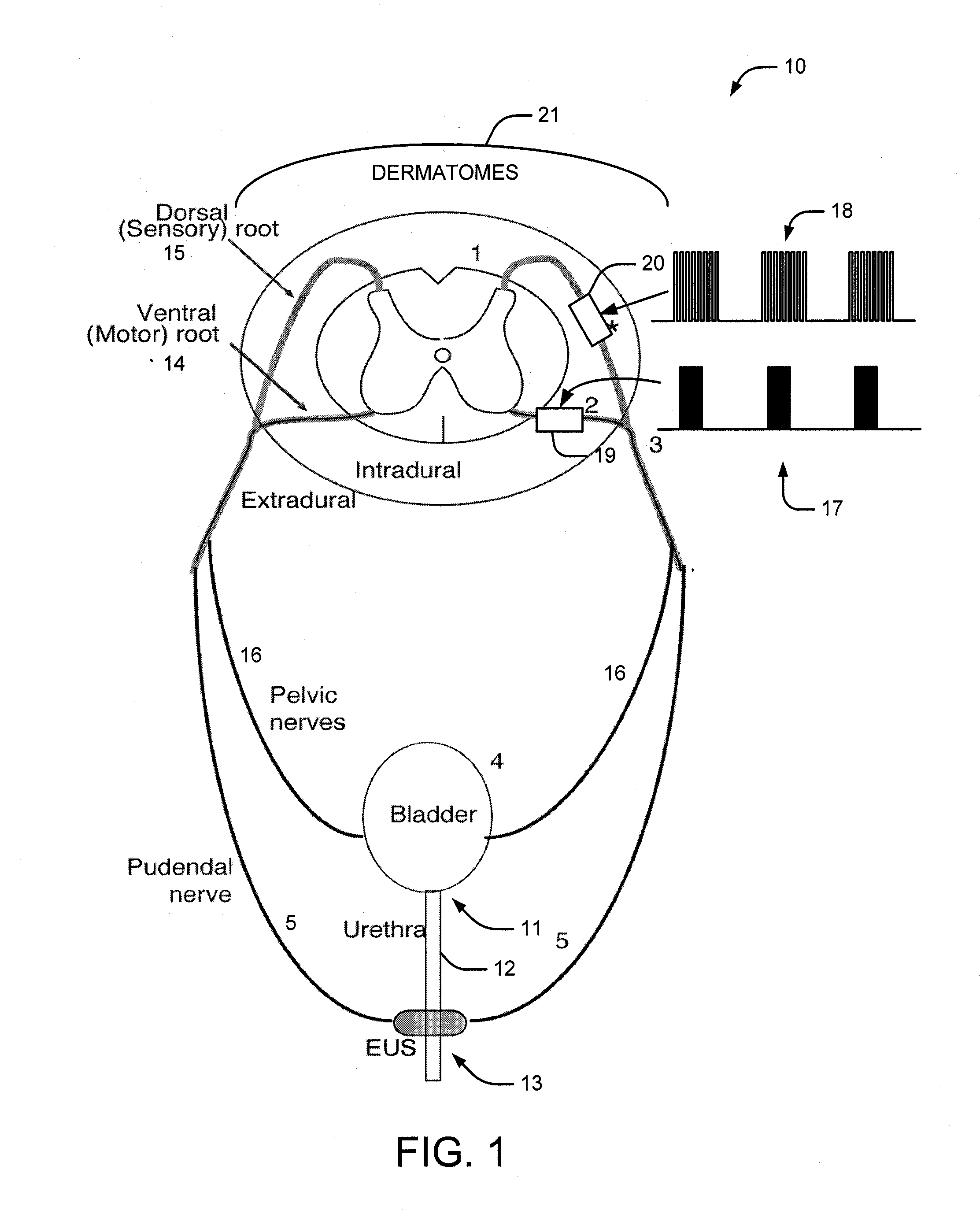 System and method of bladder and sphincter control