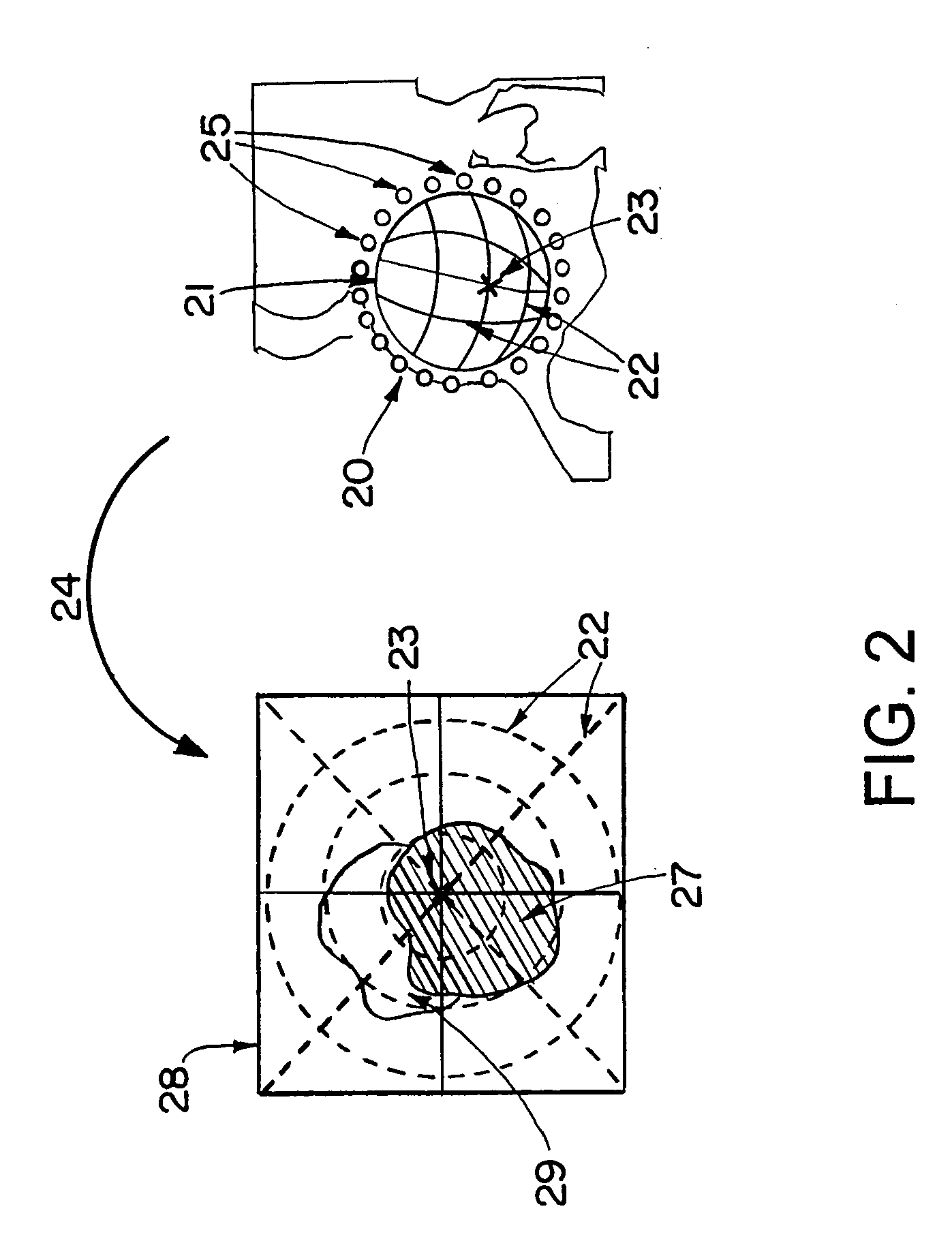 Computer-assisted joint analysis using surface projection