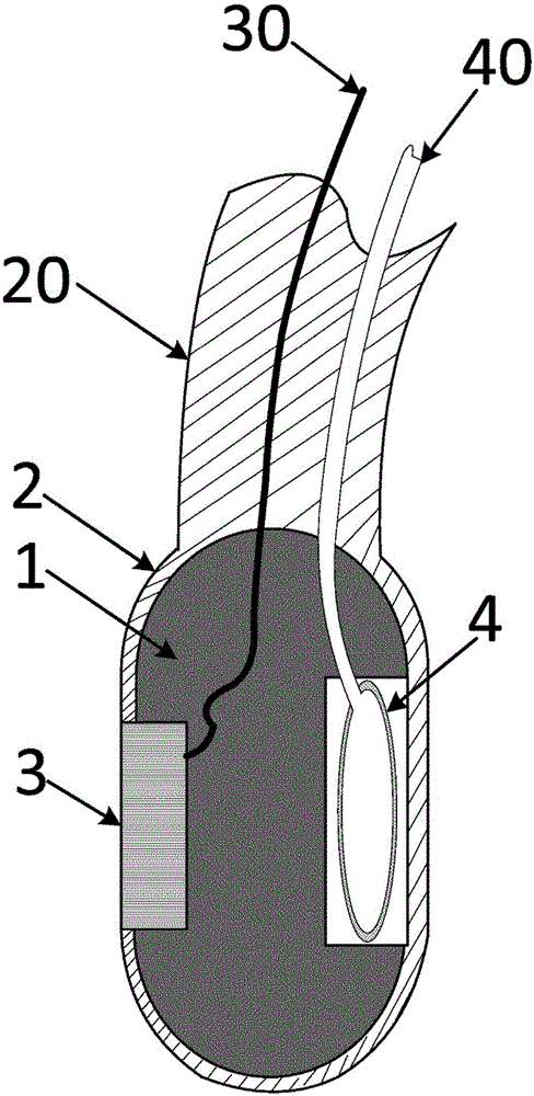 Medical ultrasonic esophagoscope tube, and medical ultrasonic esophagoscope