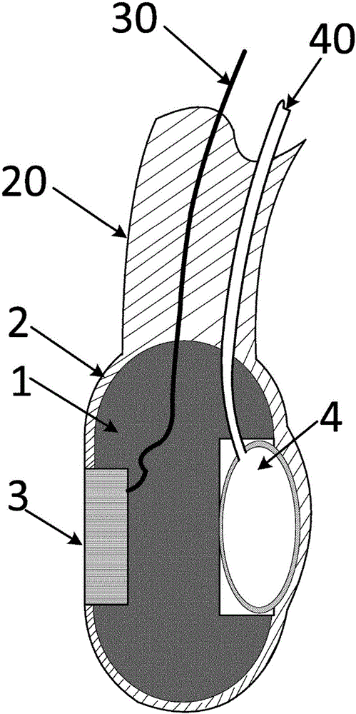 Medical ultrasonic esophagoscope tube, and medical ultrasonic esophagoscope