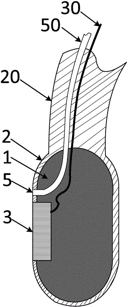 Medical ultrasonic esophagoscope tube, and medical ultrasonic esophagoscope