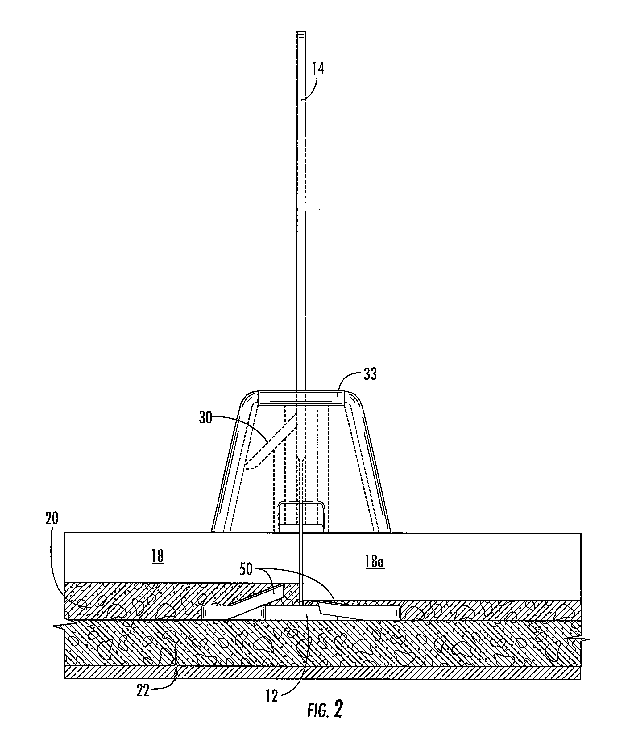 Tile alignment and leveling device