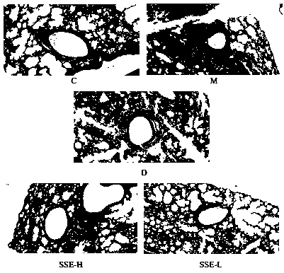 Application of shuteria root total flavonoid extract