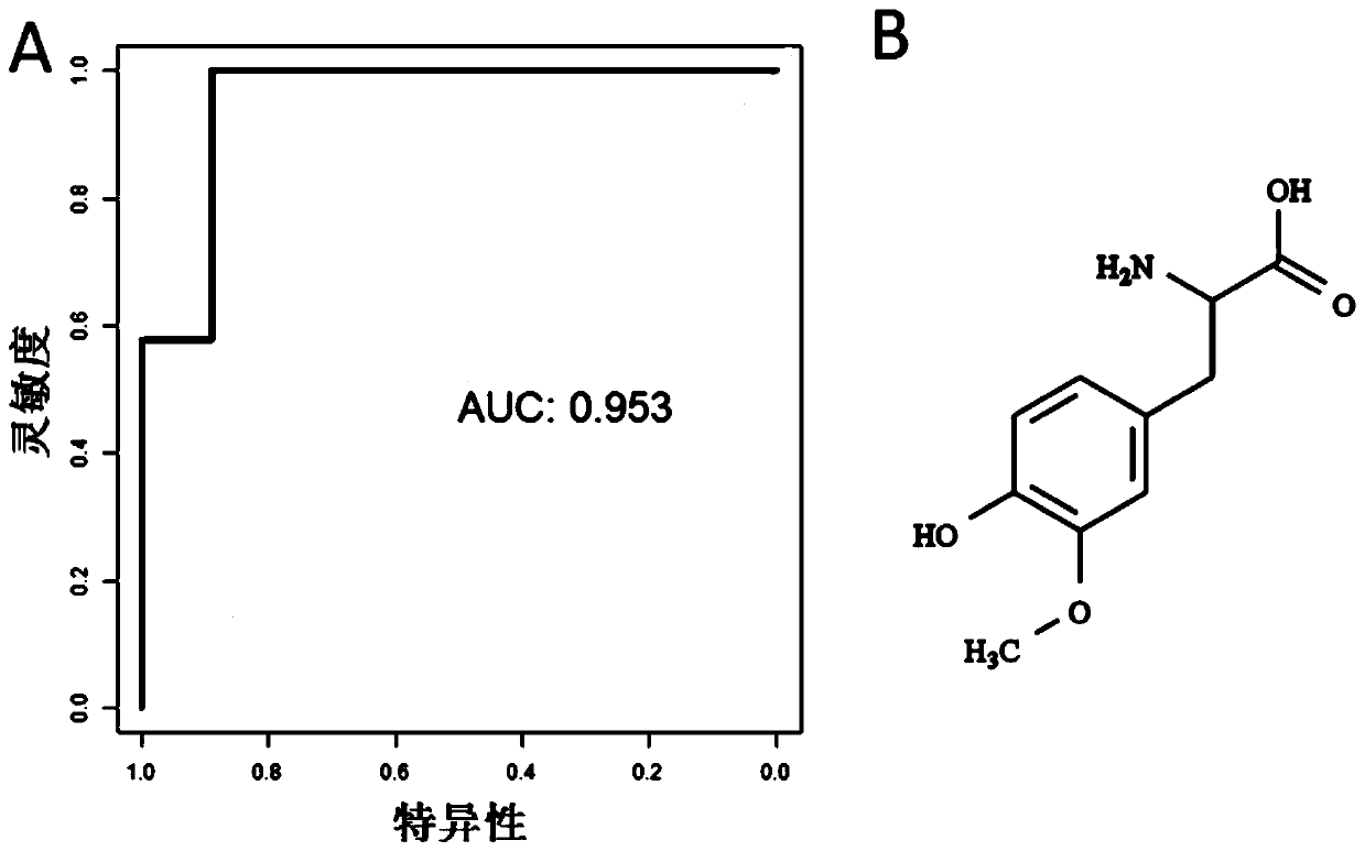 Parkinson's disease specific serum endogenous small molecule marker and application thereof