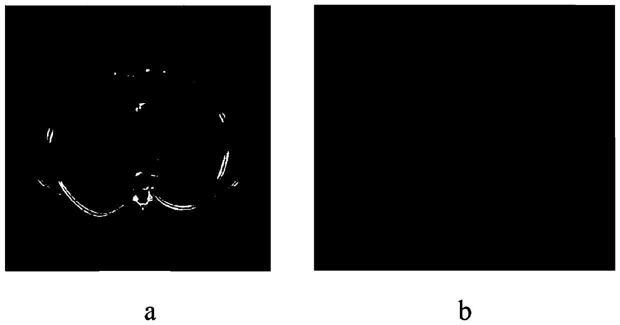 Enhanced low-rank sparse decomposition model medical CT image denoising method
