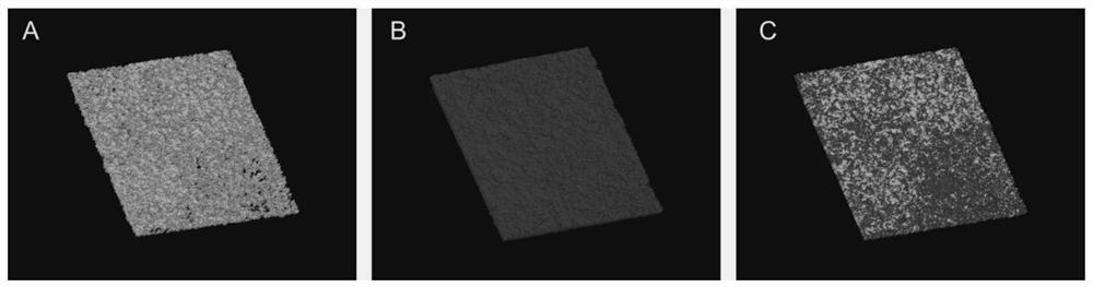 Double-targeting composite nano-system loaded with amphotericin B and beta-1,3-glucanase, and preparation method and application of double-targeting composite nano-system