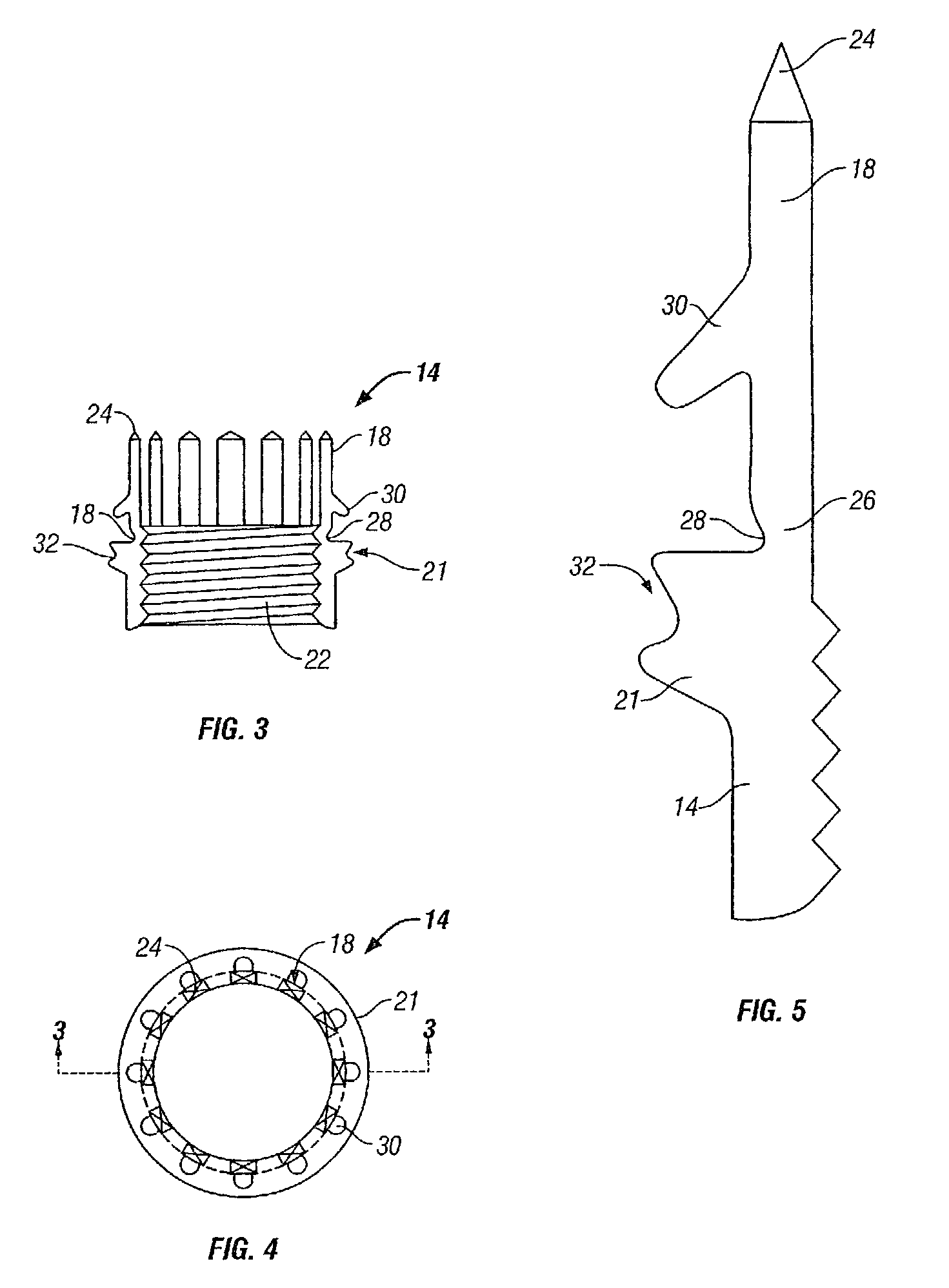 Perorally insertable/removable anti-reflux valve