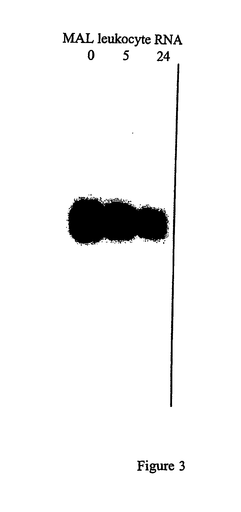 Galectin-14 therapeutic molecule and uses thereof