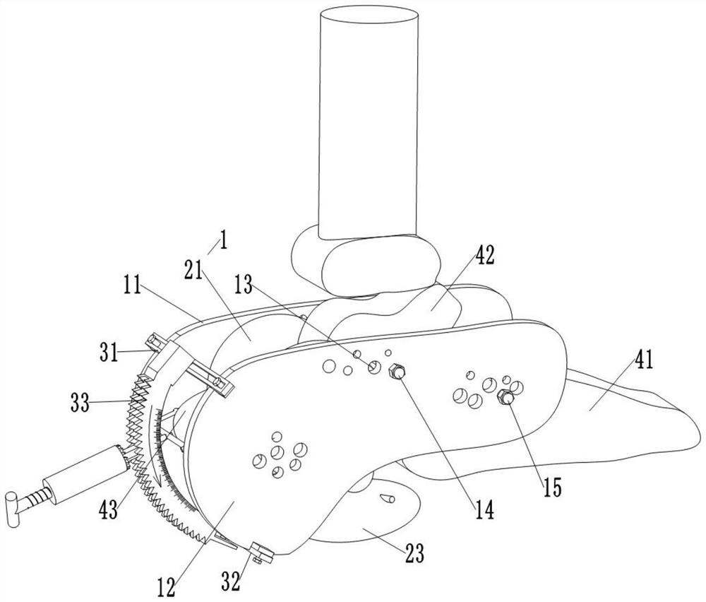 Closed reduction device for comminuted calcaneal fracture