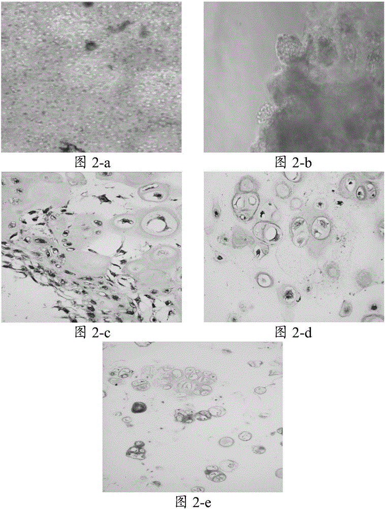 Culture system and application thereof as well as method for culturing cartilage cells