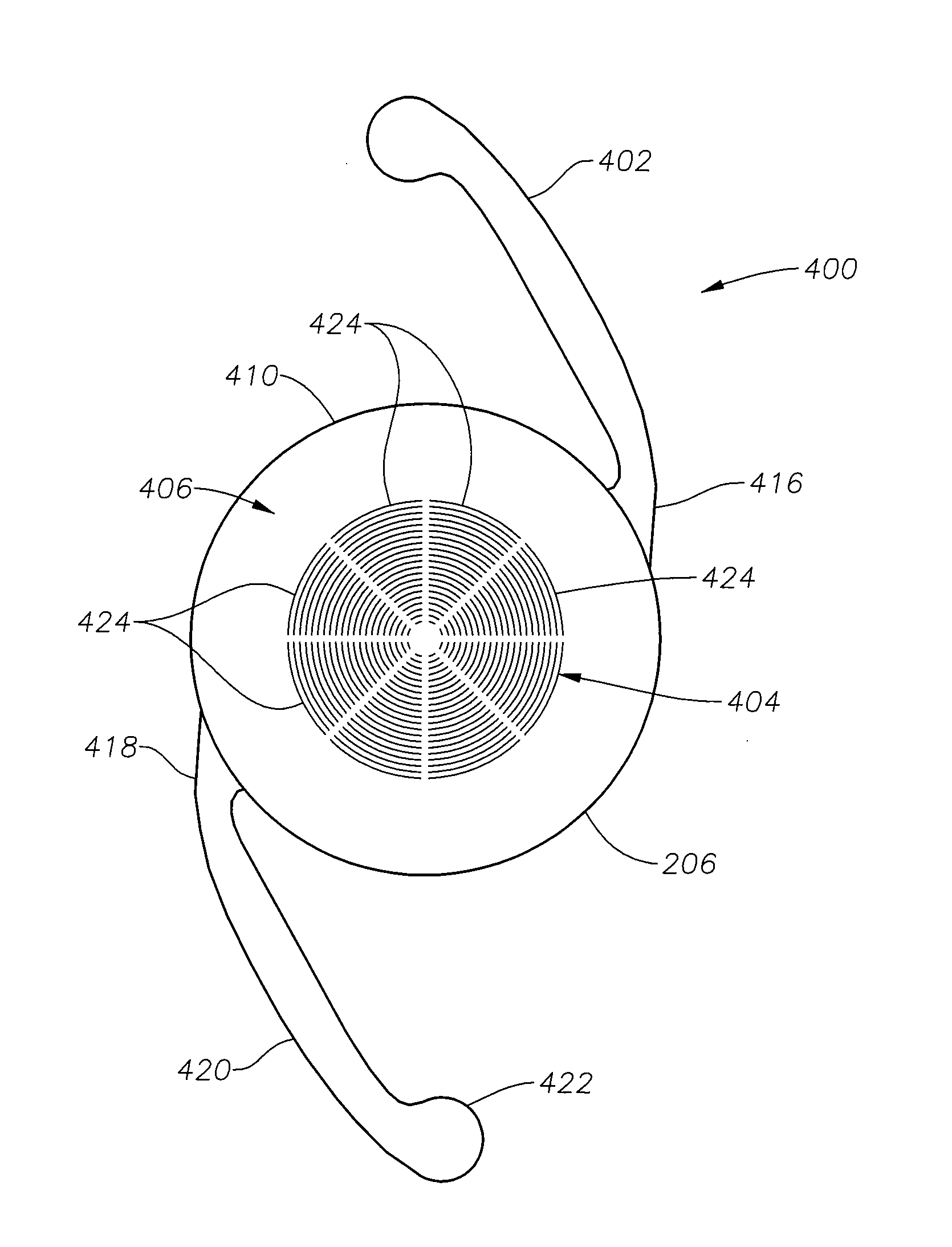 Radially segmented apodized diffractive multifocal design for ocular implant