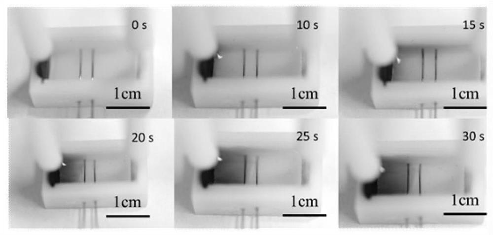 Sensor based on bipolar electrode structure and method for non-enzyme detection of glucose