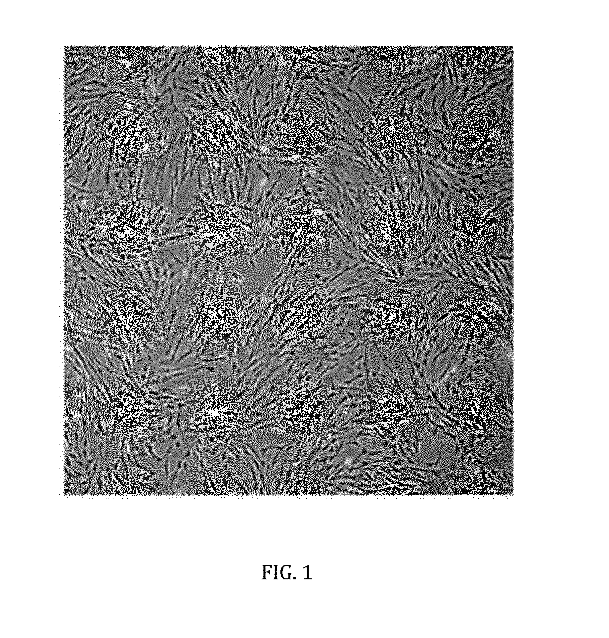 Cell-based composition and use thereof for treatment of macular oedema and degeneration