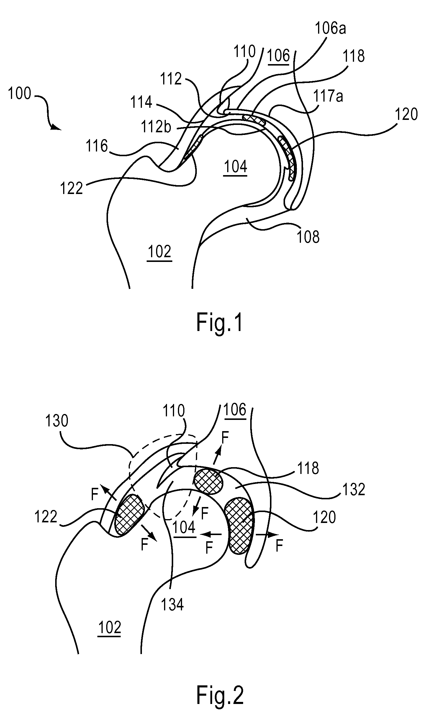 Device and Method for Hip Distention and Access