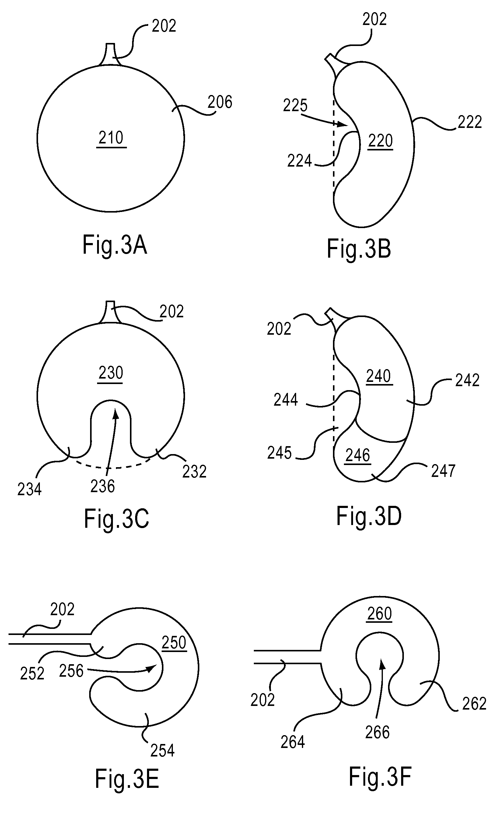 Device and Method for Hip Distention and Access