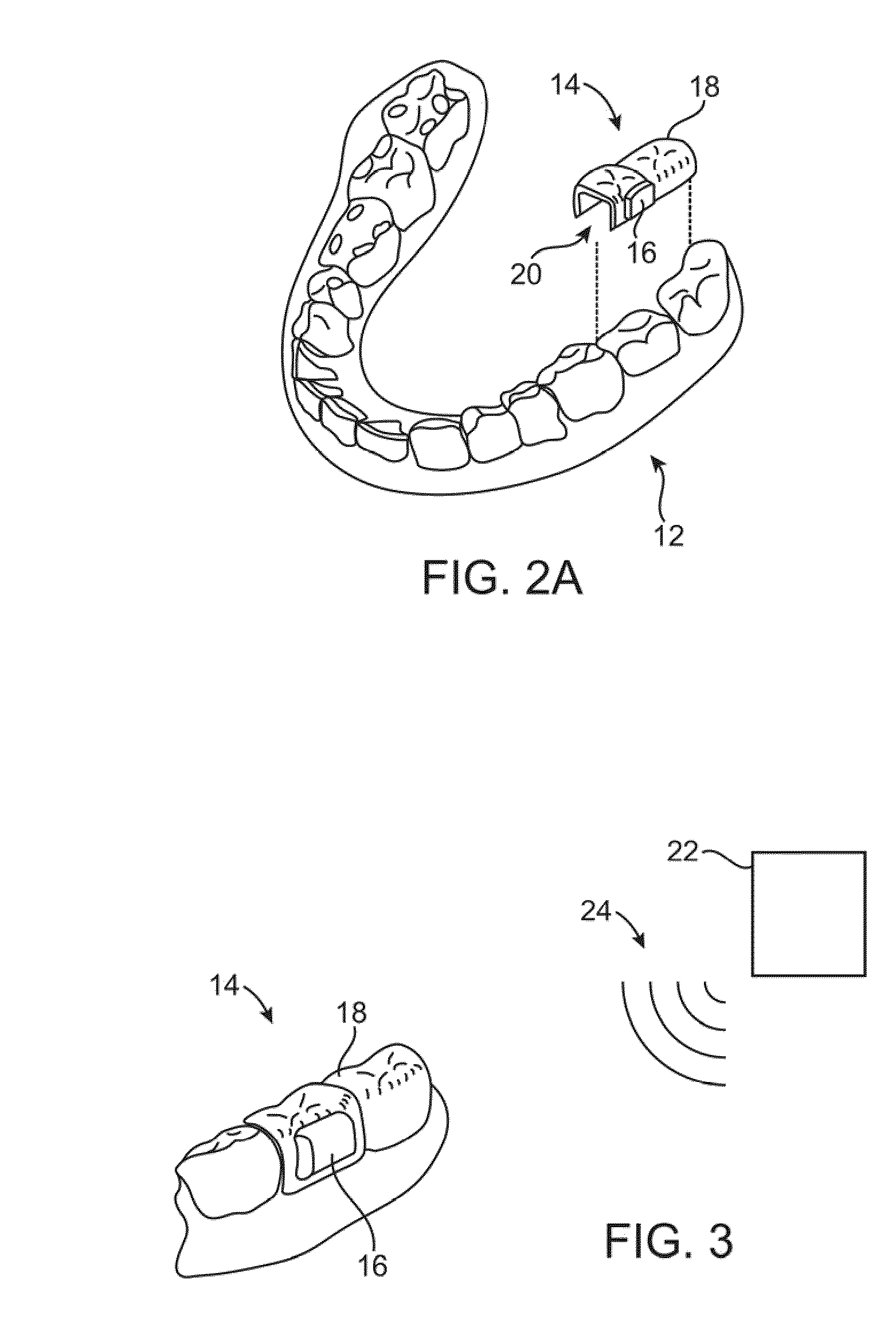 Microphone placement for oral applications