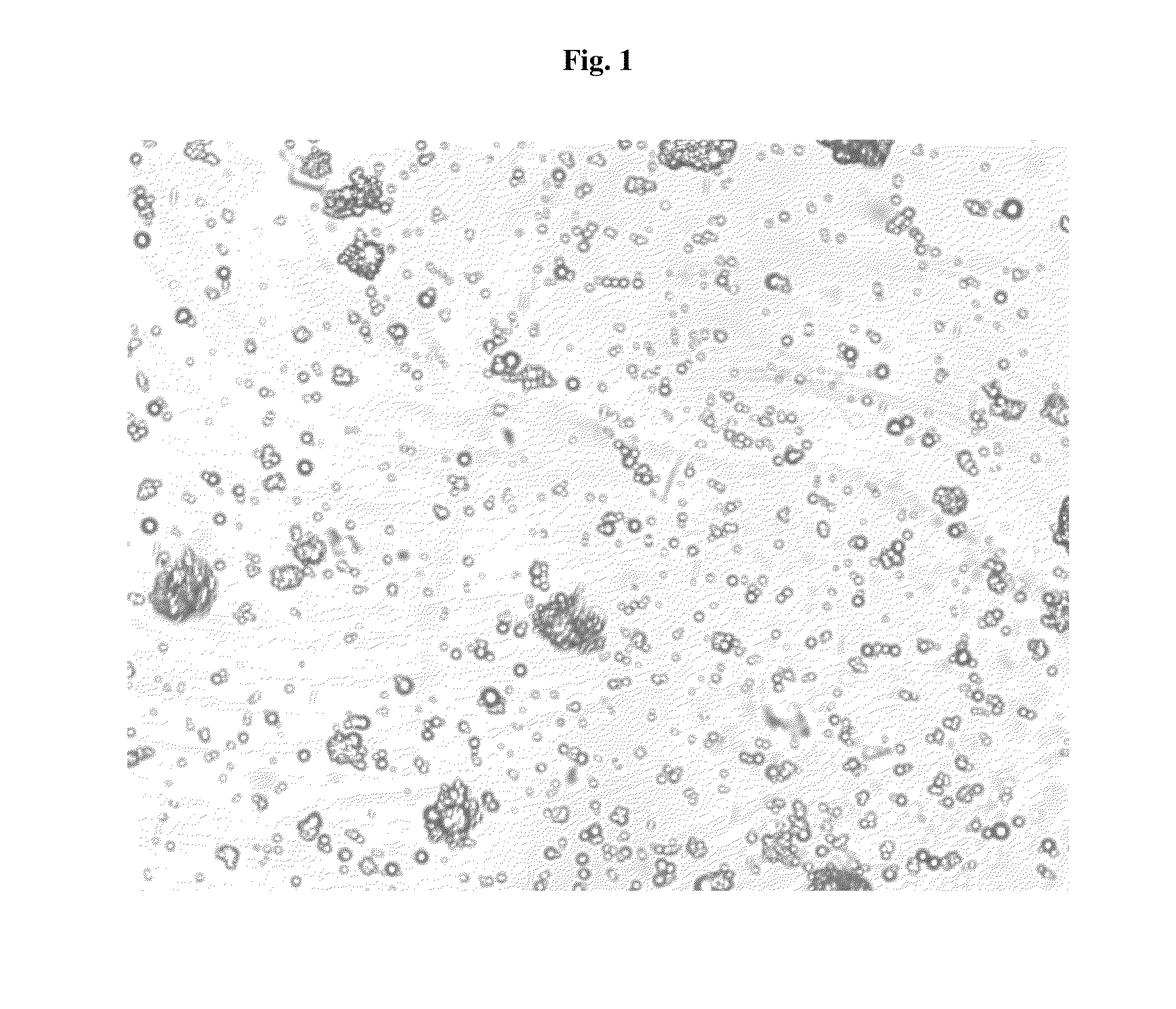 Pharmaceutical Compositions Comprising Phosphate-Binding Polymer