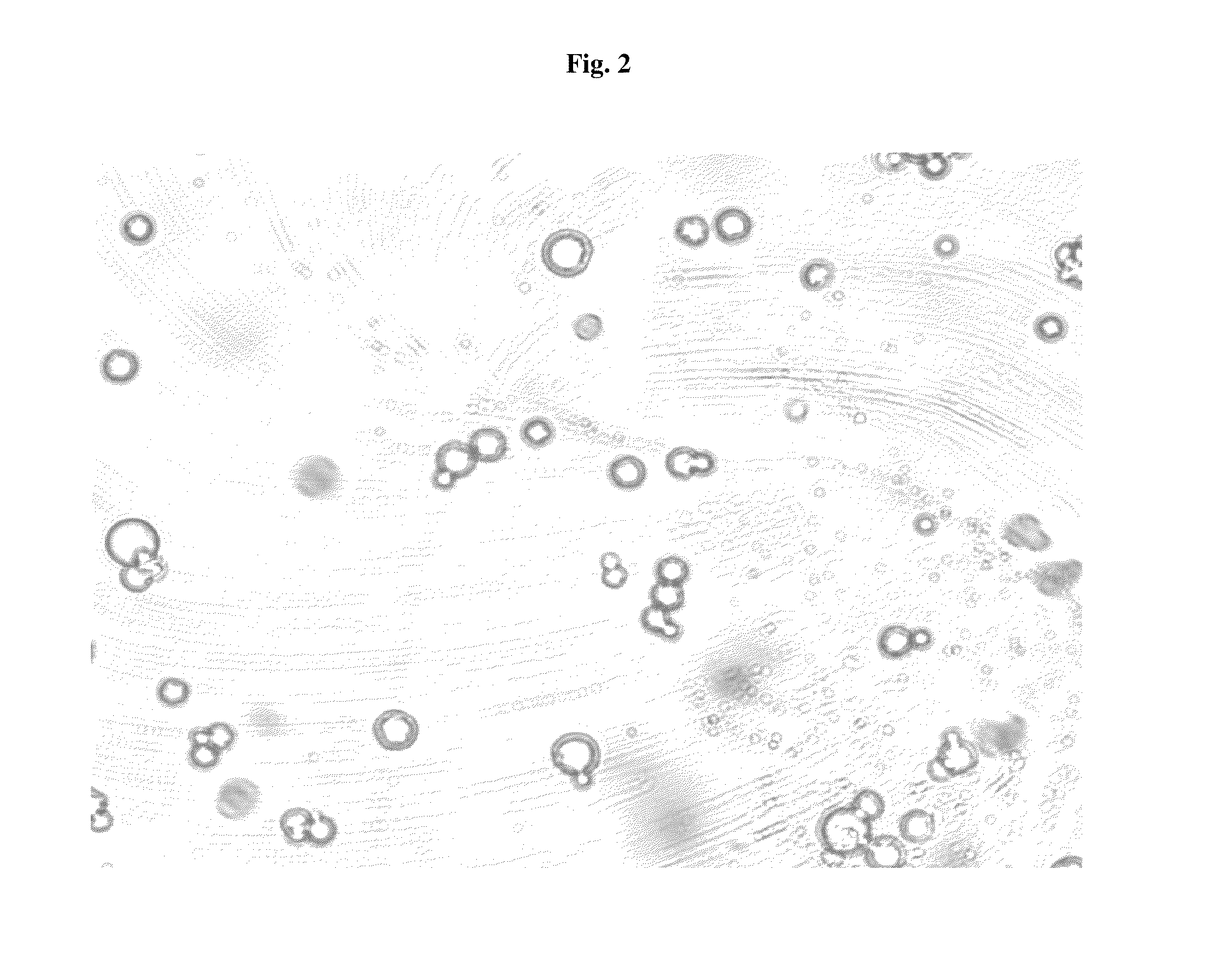 Pharmaceutical Compositions Comprising Phosphate-Binding Polymer