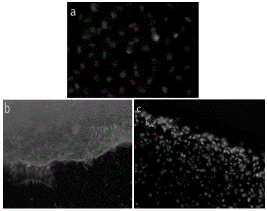 BMP-loaded silk fibroin/collagen scaffold material and preparation method thereof