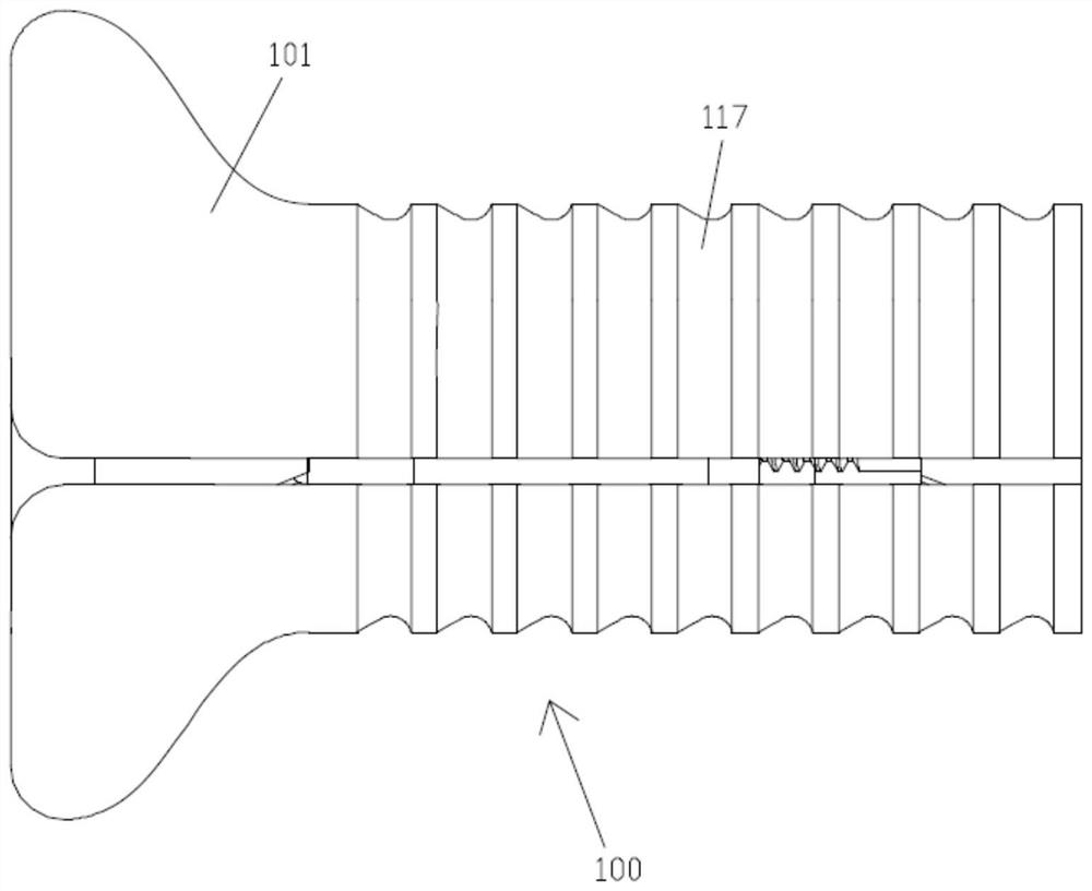 Tarsal sinus stabilizer for talus turning