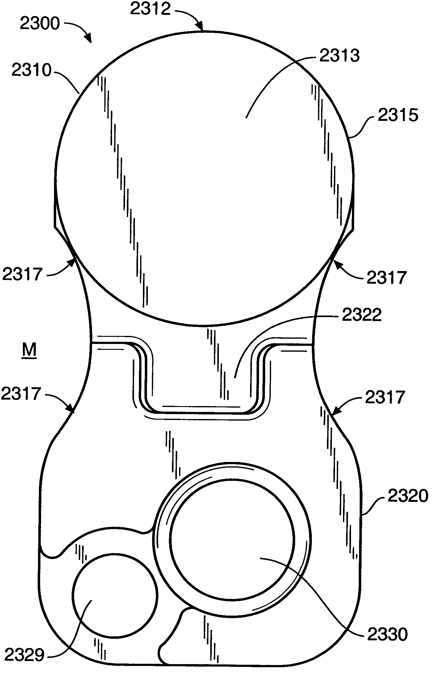 Inter-cervical facet implant with locking screw and method