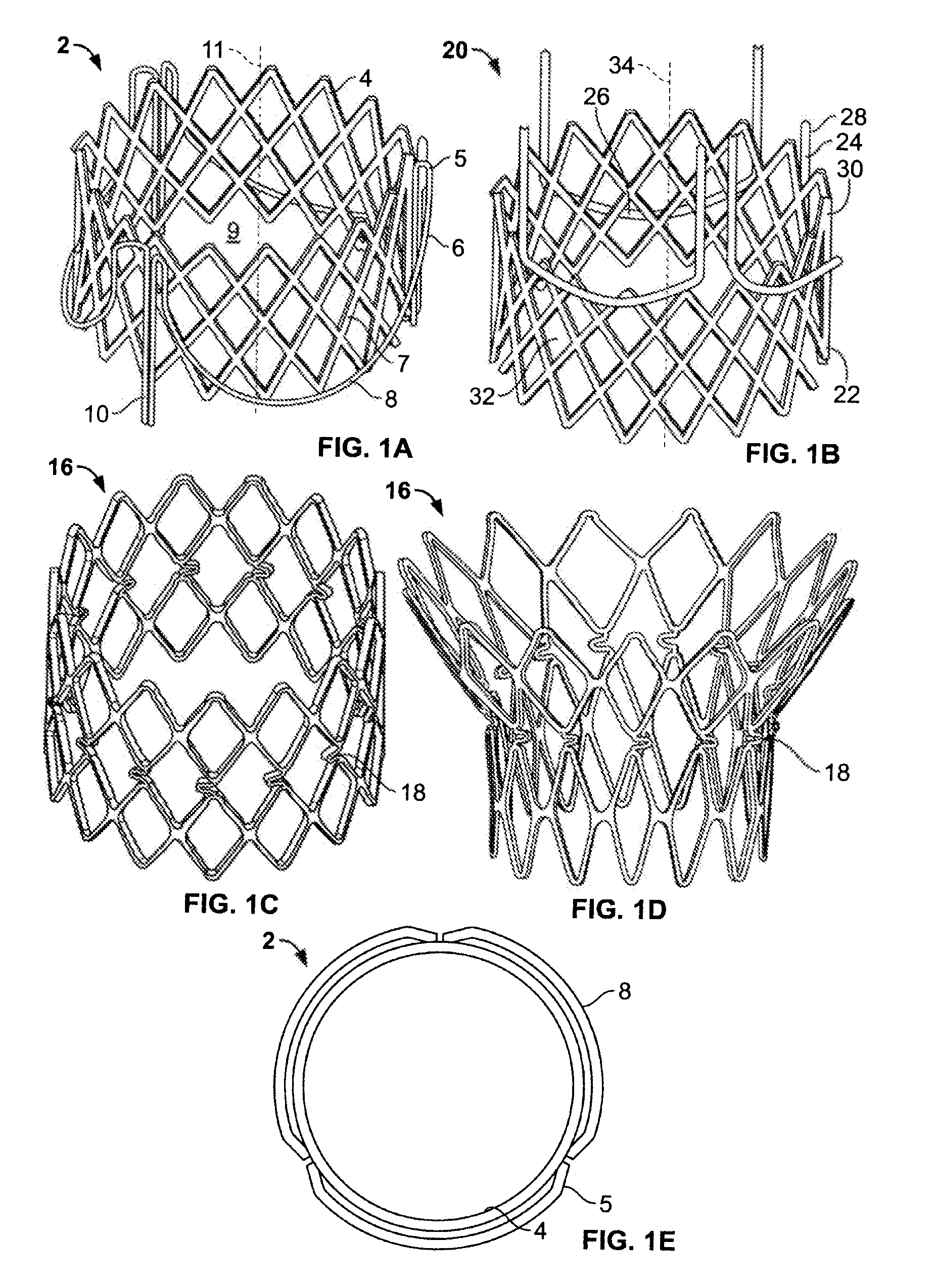 Devices and methods for delivery of aortic and mitral valve prostheses