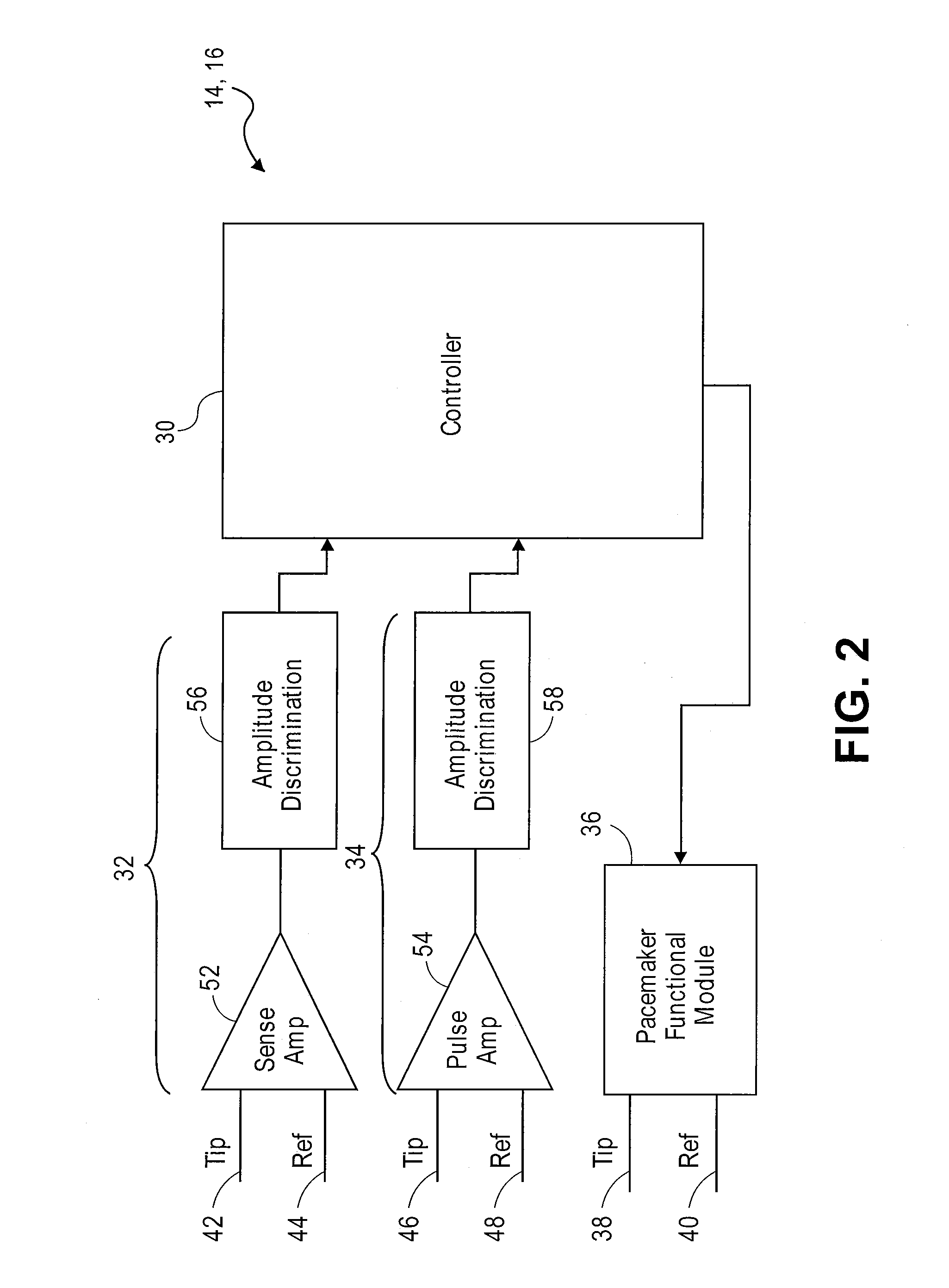 Method and system for tracking events of interest between leadless and subcutaneous implantable cardioverter devices