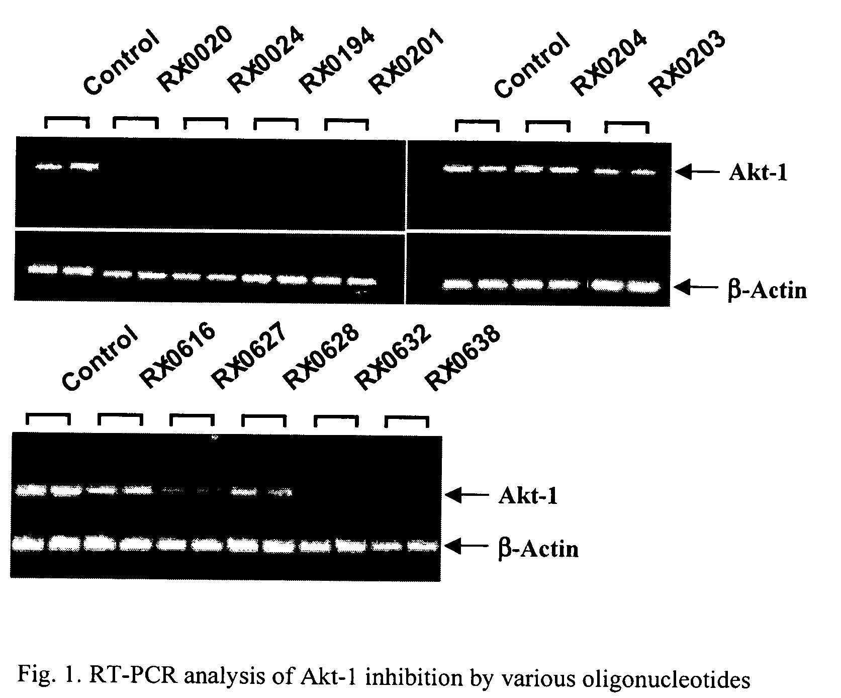 Use of antisense oligonucleotides to inhibit the expression of human Akt-1