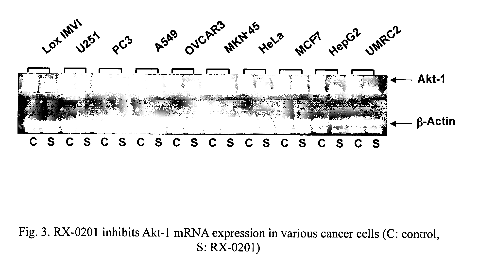 Use of antisense oligonucleotides to inhibit the expression of human Akt-1
