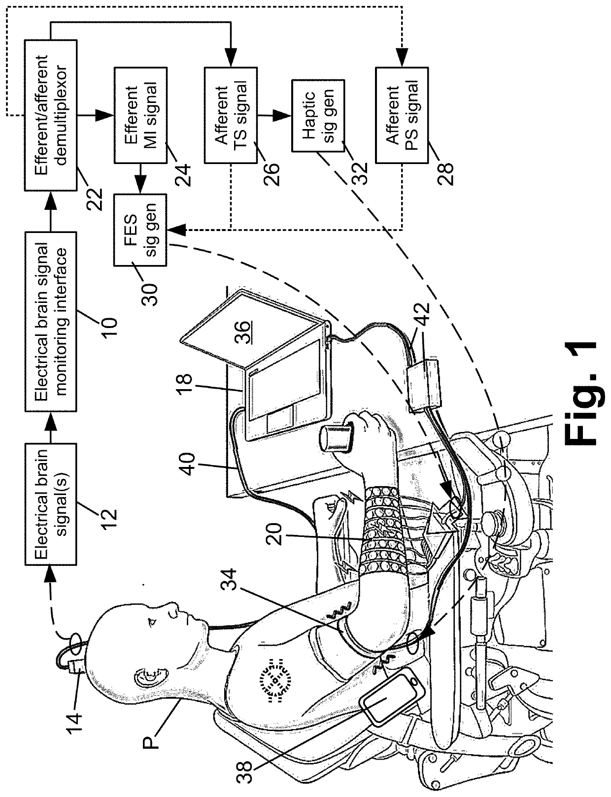 Motor function neural control interface for spinal cord injury patients