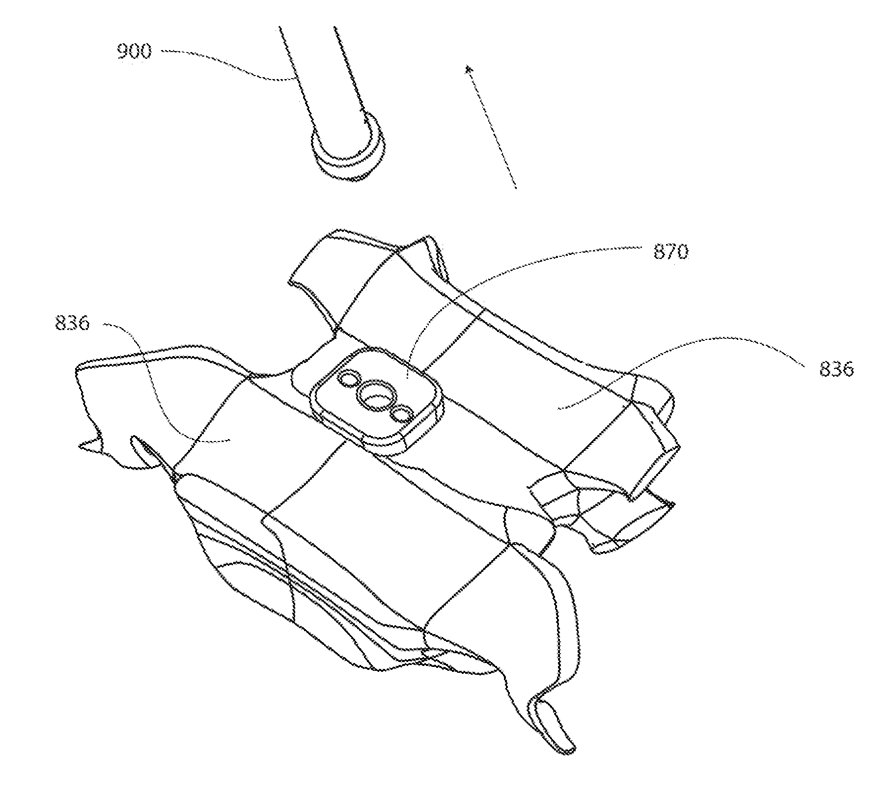 Implantable vertebral frame systems and related methods for spinal repair