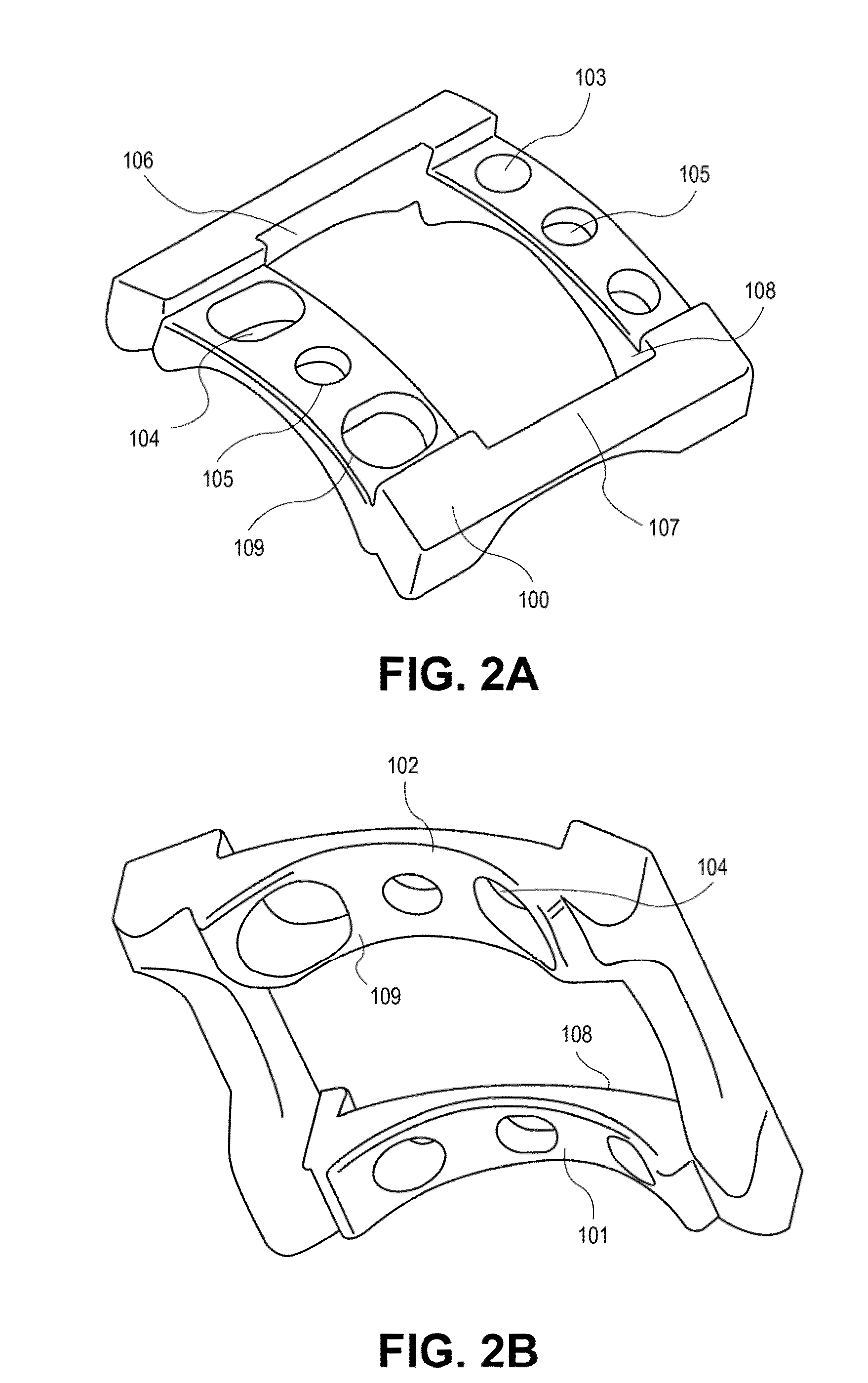 Implantable vertebral frame systems and related methods for spinal repair