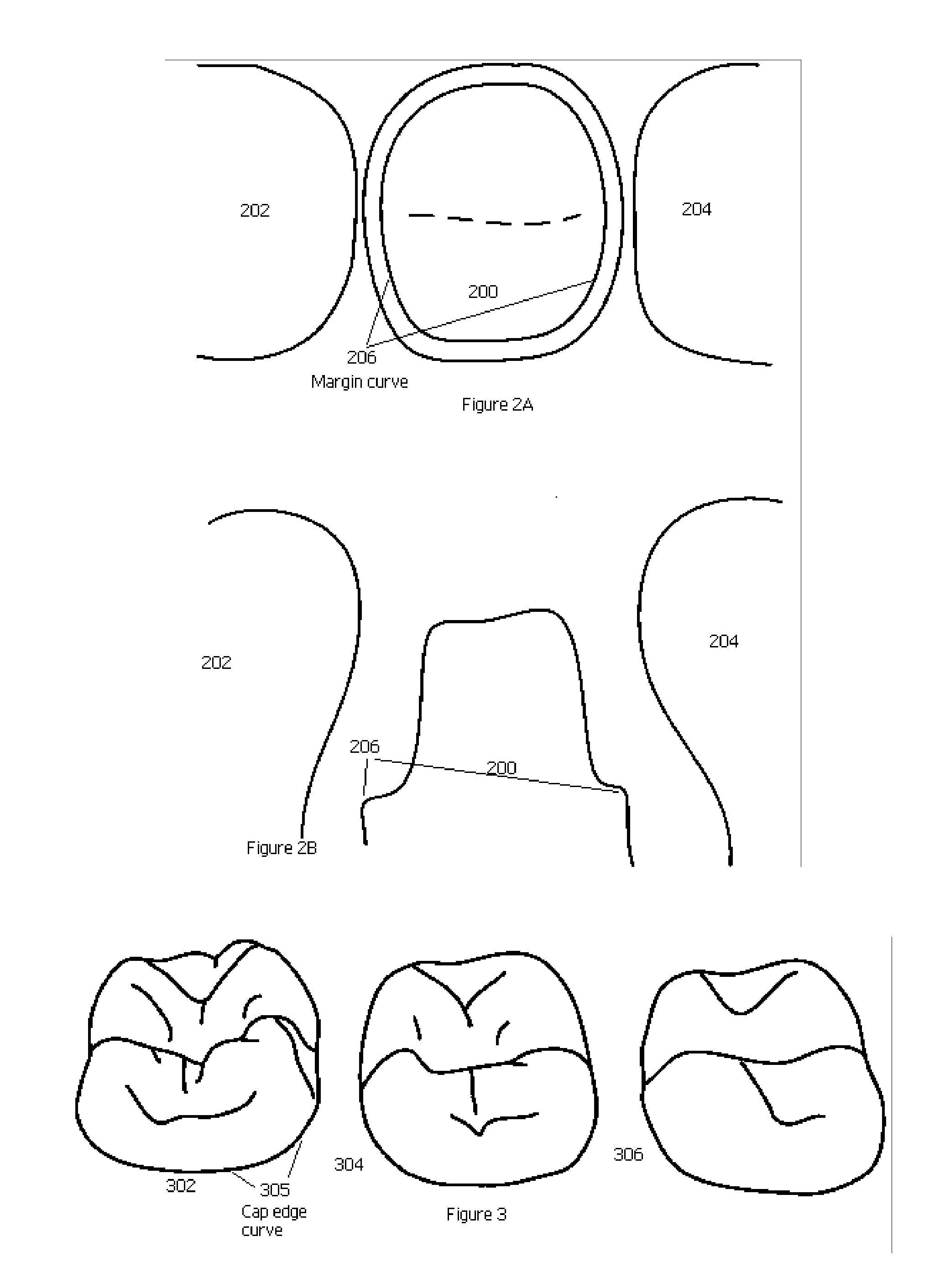 Method and computer system for creating a dental restoration model