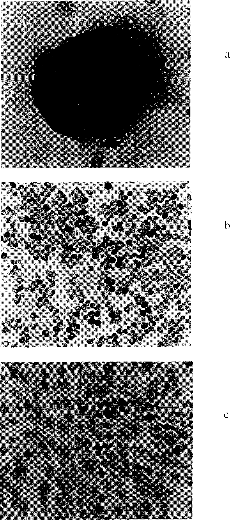 Method for amplifying NSCs and inhibiting it to neuroglial cell differentiation and its use