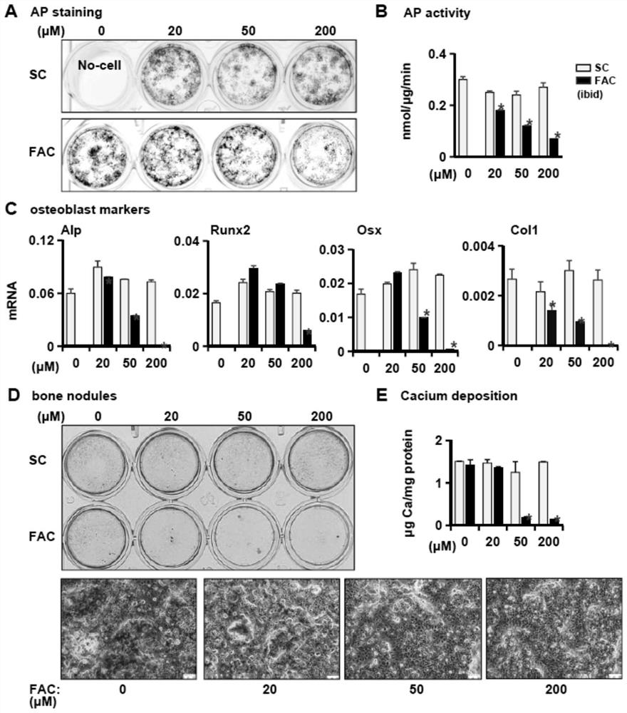 Application of ferroptosis inhibitor in preparation of medicine for preventing or treating osteoporosis or bone loss caused by iron overload