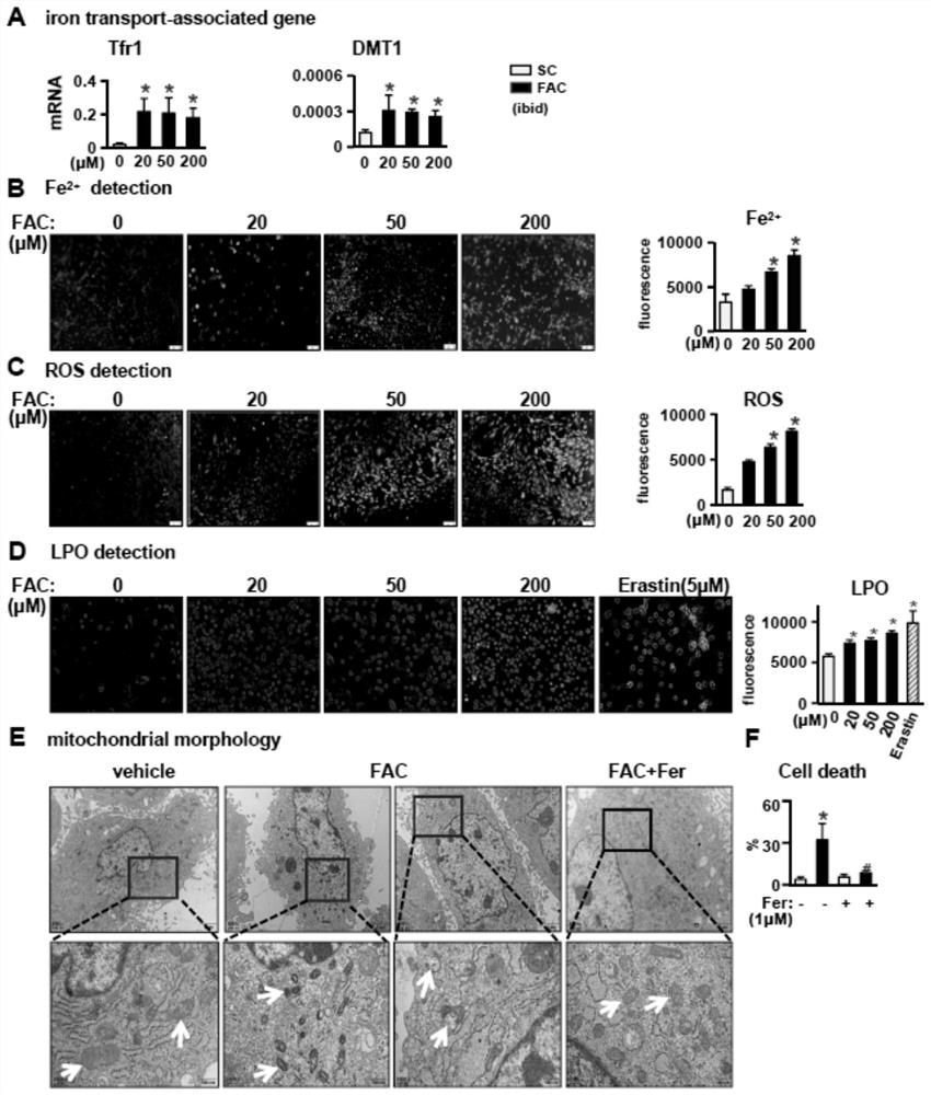 Application of ferroptosis inhibitor in preparation of medicine for preventing or treating osteoporosis or bone loss caused by iron overload