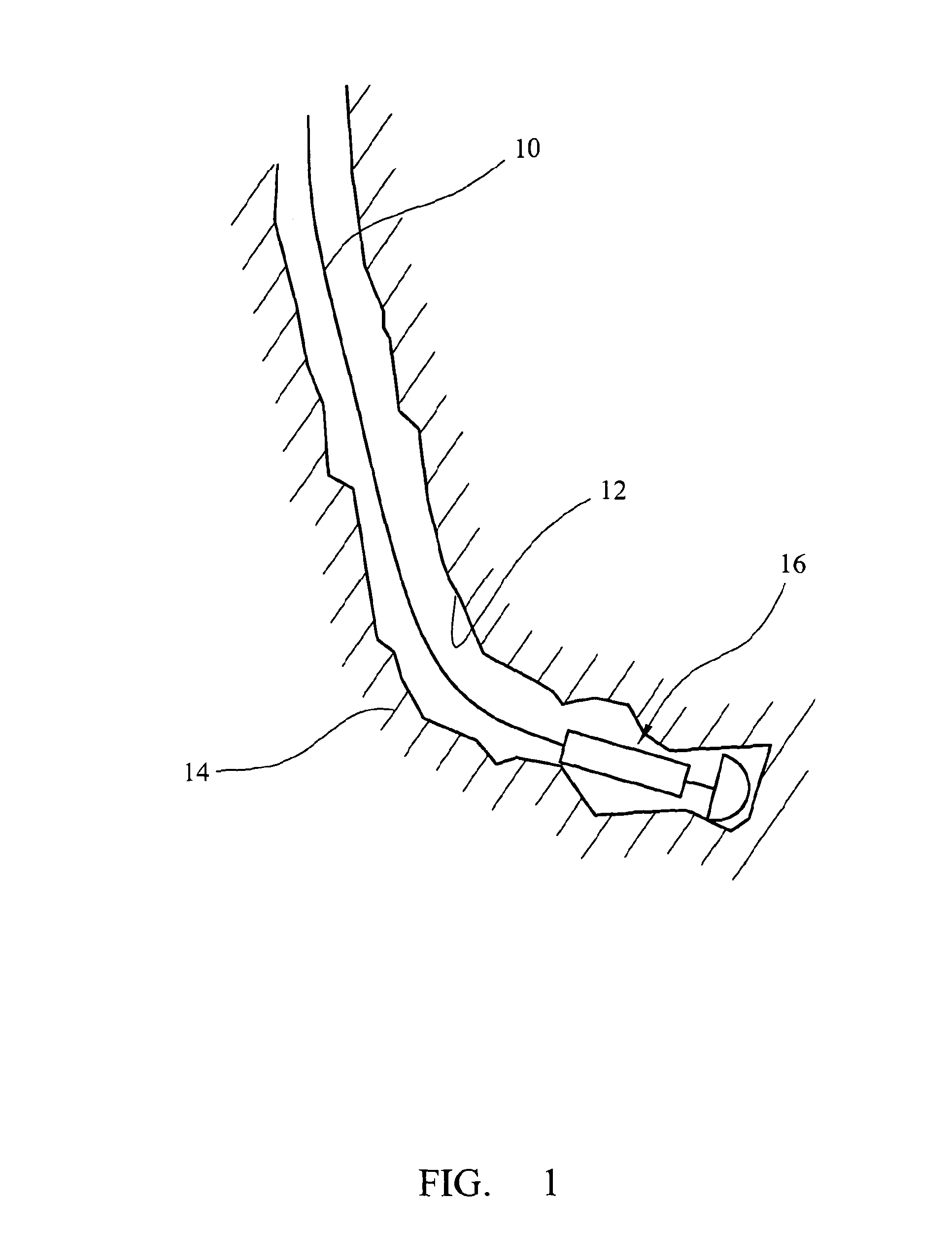 Method and apparatus for applying vibrations during borehole operations