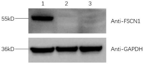 Method for constructing FSCN1 gene stable knockout cell line, plasmid or plasmid combination and application thereof