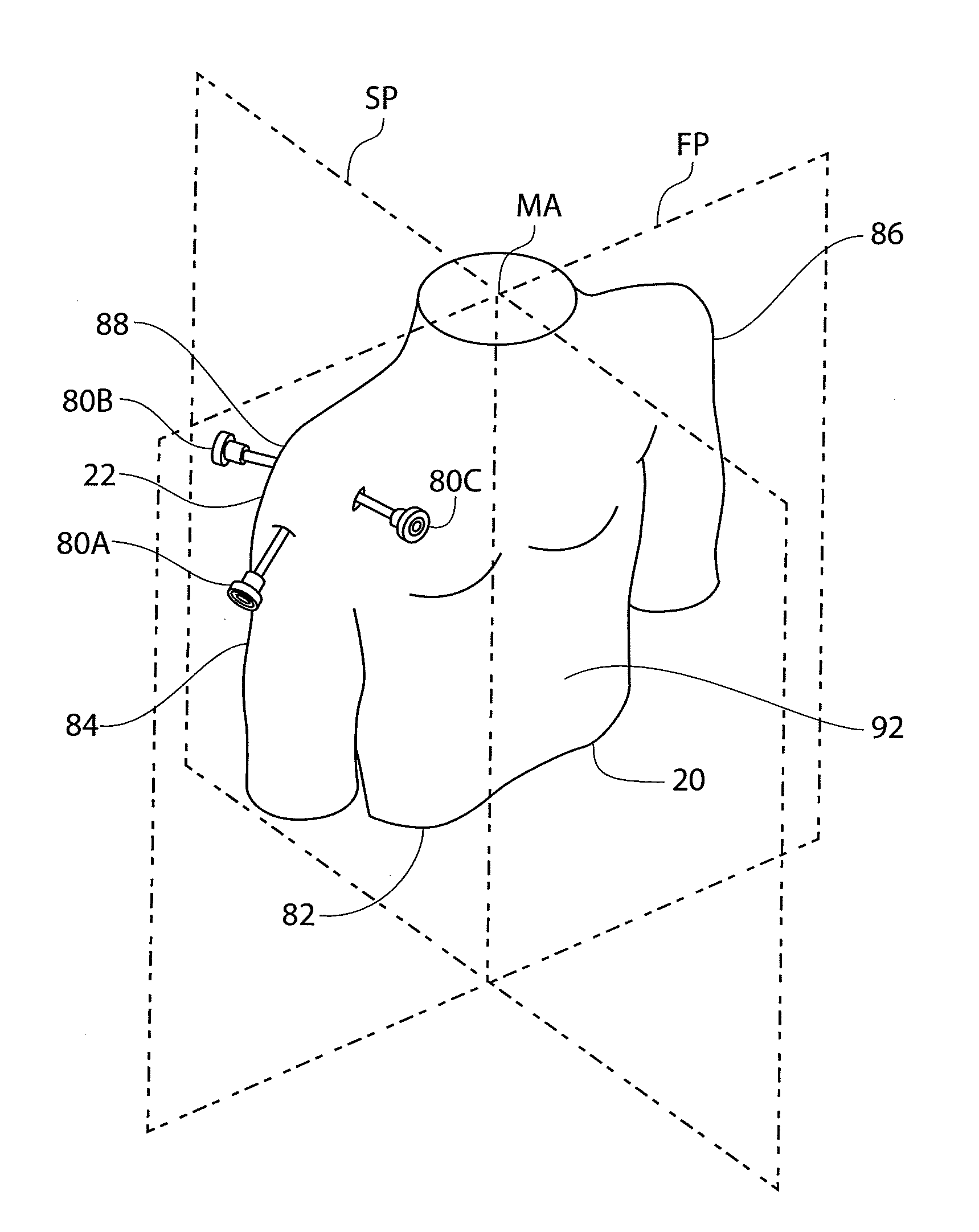 Guidewire having a distal fixation member for delivering and positioning sheet-like materials in surgery