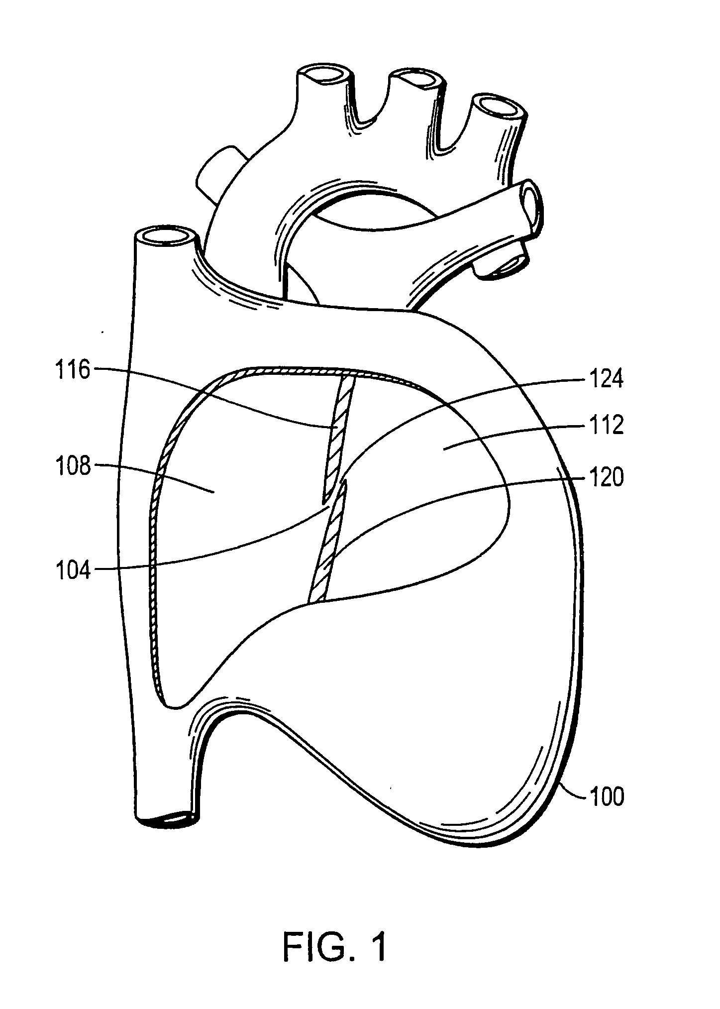 Device with biological tissue scaffold for percutaneous closure of an intracardiac defect and methods thereof