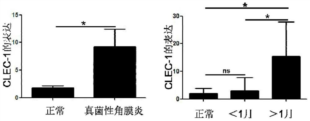Application of C-type lectin-like receptor-1 as therapeutic marker of fungal keratitis