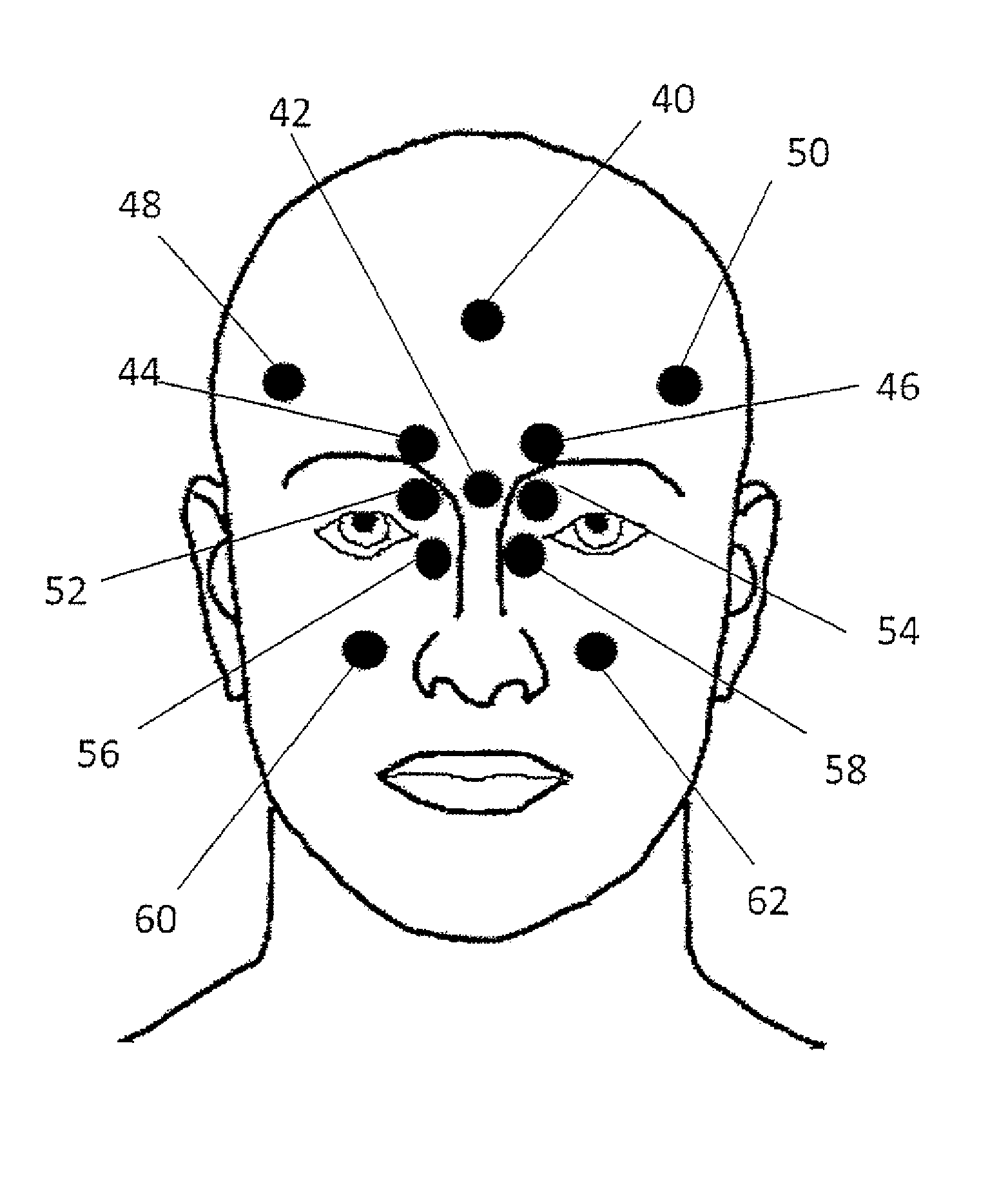 Method for diagnosing selected conditions using thermography