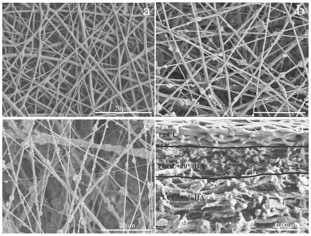 A composite electrospun membrane for promoting tendon-bone healing and its preparation method and application