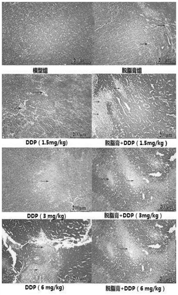 Application of American cockroach extract skimmed cream in DDP, anti-tumor medicine for toxicity reduction and efficacy enhancement