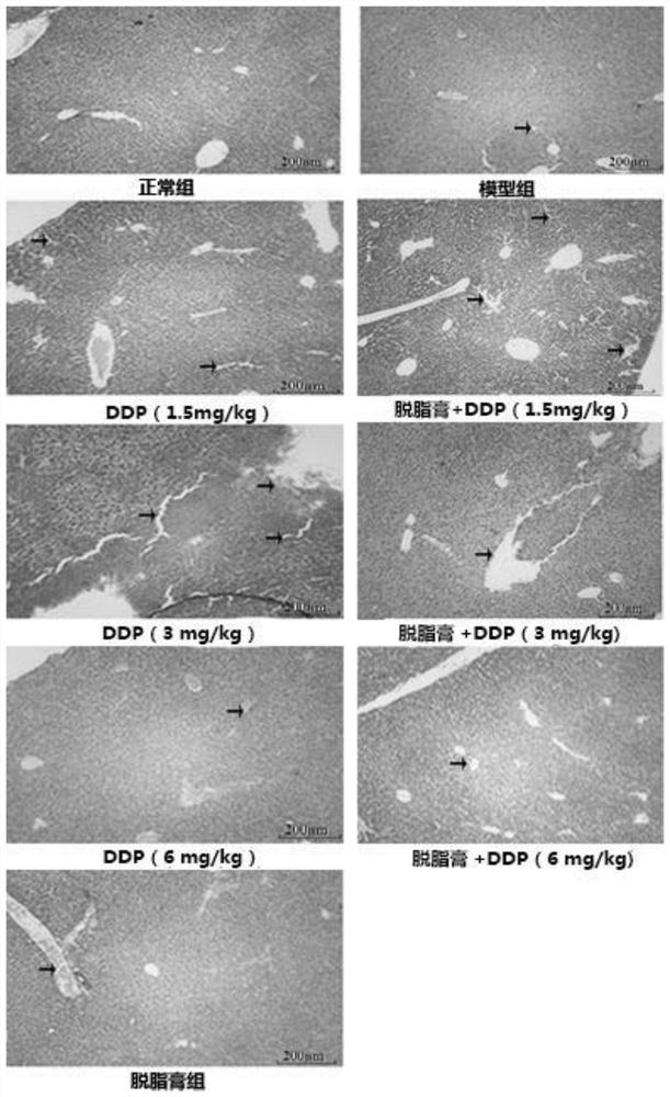 Application of American cockroach extract skimmed cream in DDP, anti-tumor medicine for toxicity reduction and efficacy enhancement