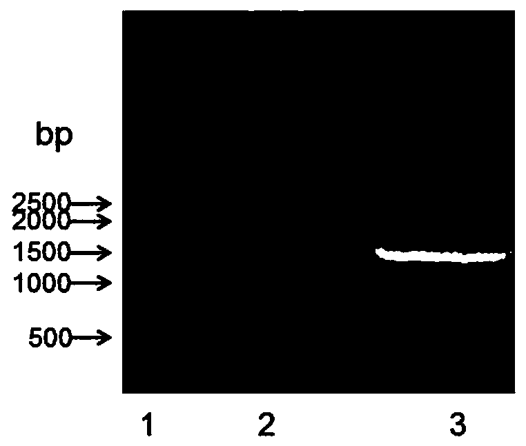 Immunohistochemical detection kit for human CD26 and clinical application thereof